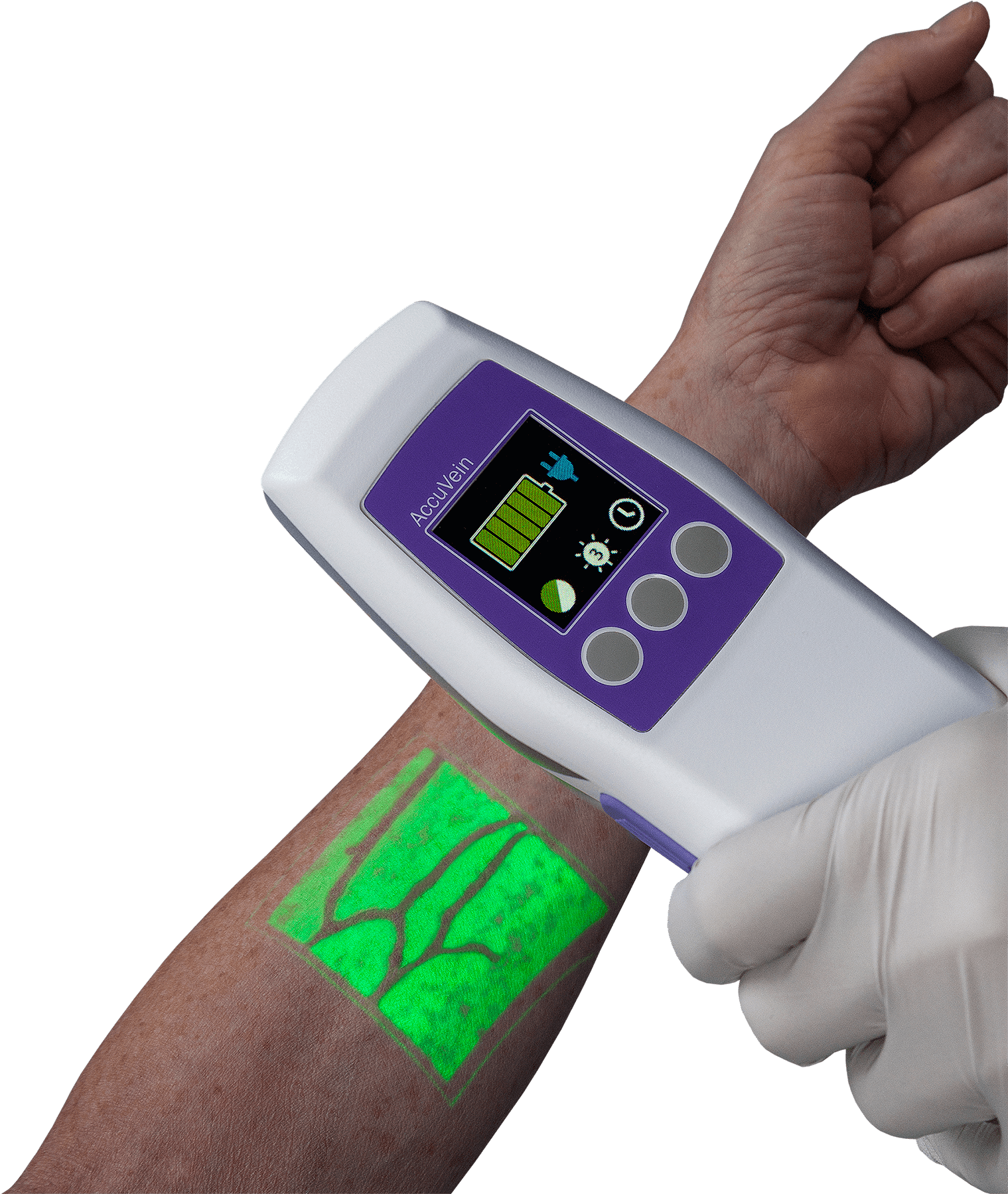  What is a vein finder : An Essential Guide to Innovative Medical Technology