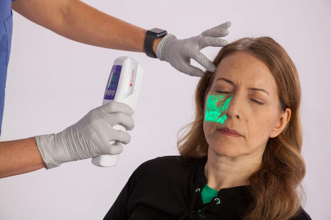 AccuVein Vein Visualization System