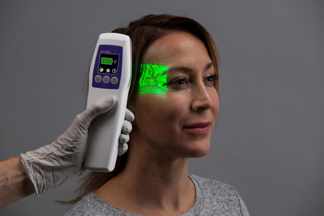 AccuVein Vein Finder scanning a patient's temple