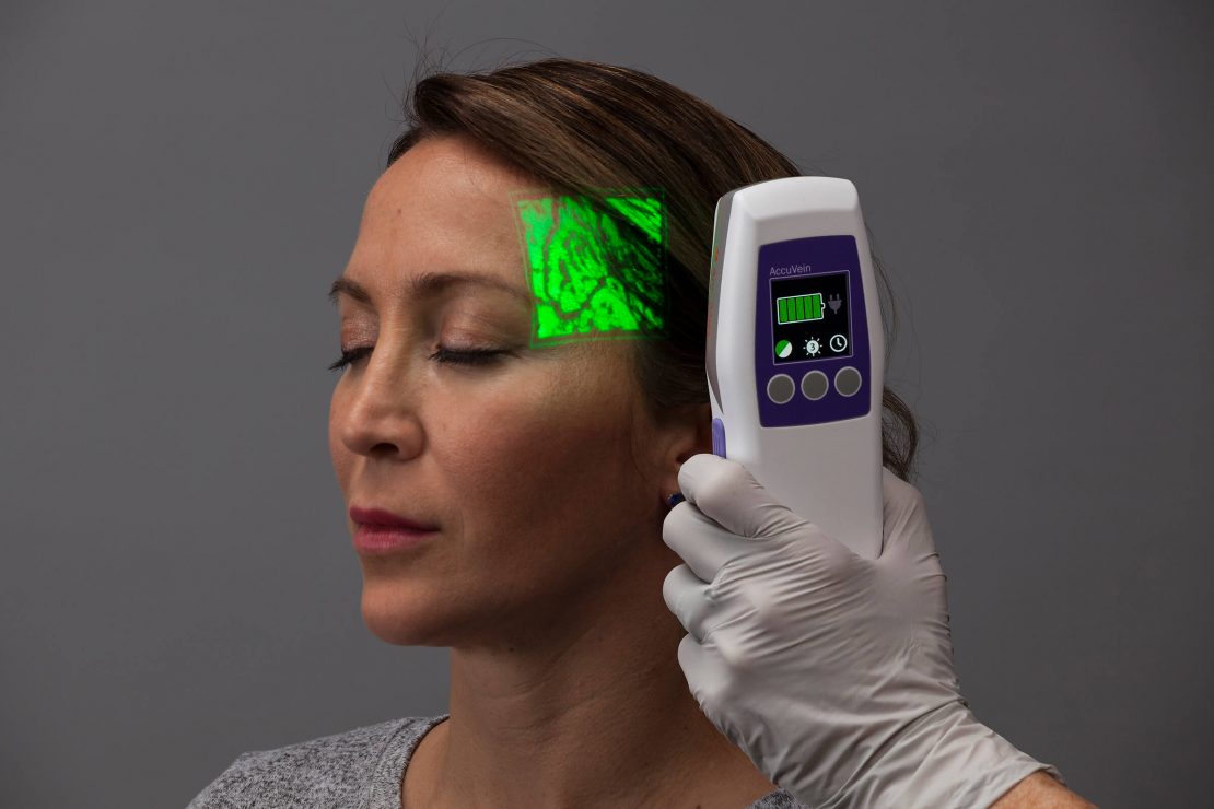 AccuVein Vein Visualization System