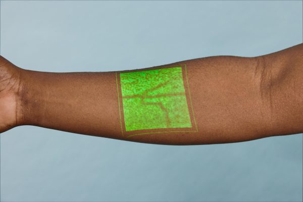 AccuVein Vein Visualization System