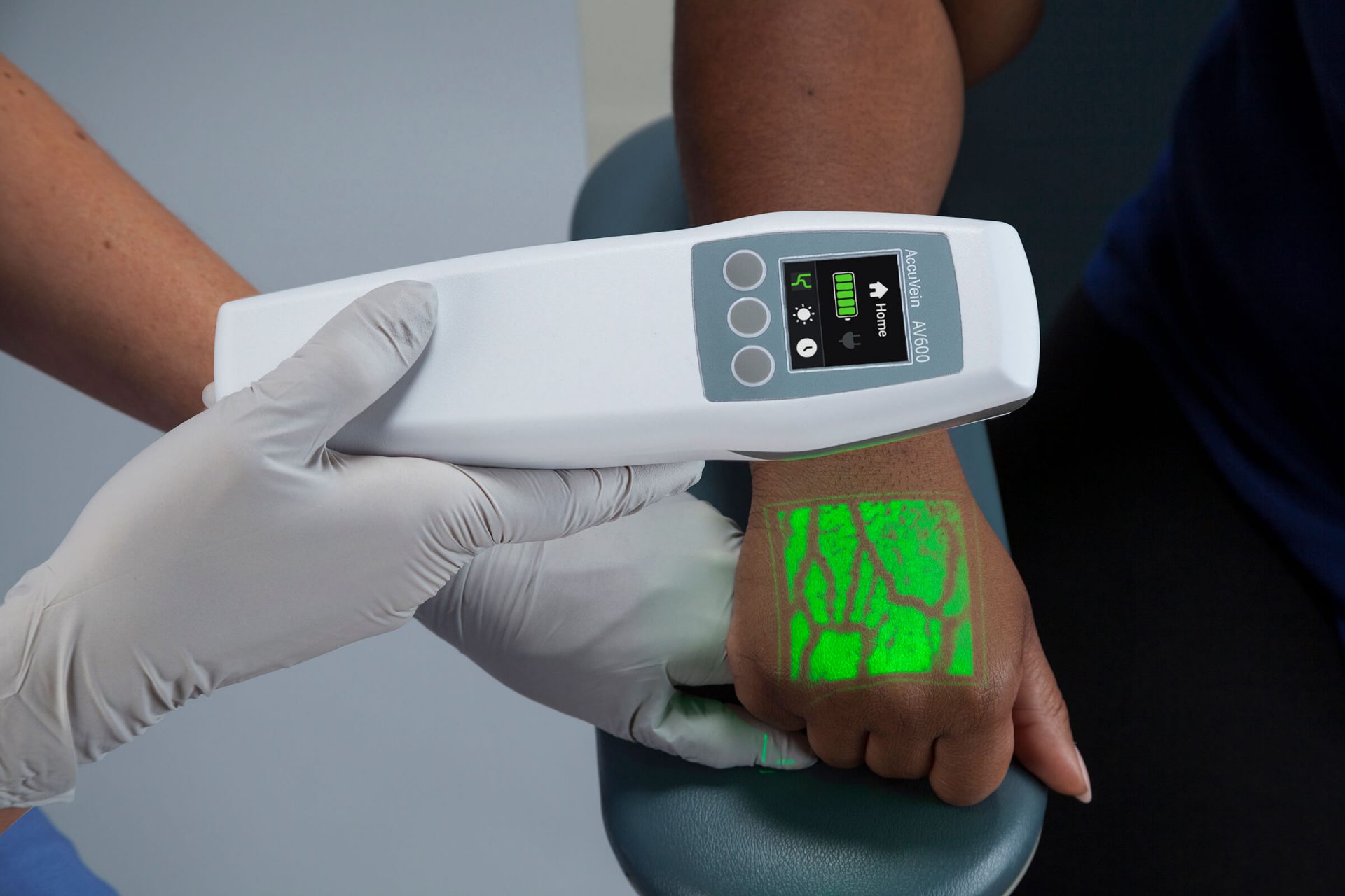 AV600 Vein Visualization System